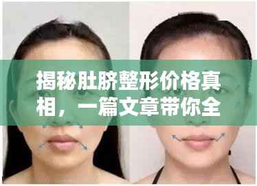 揭秘肚脐整形价格真相，一篇文章带你全面了解！